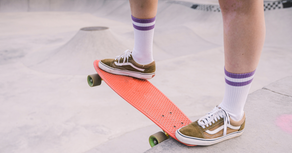 Are pressure cracks on a skateboard OK?